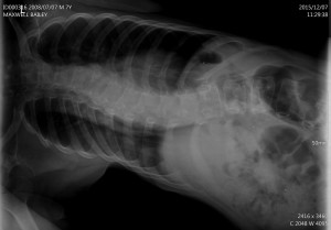 Picture of Max's x-ray laying on a Scoliroll